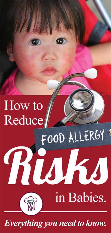 In this article you’ll learn everything you need to know about baby allergies and how to reduce the risks your child could have in getting sick.Feeding My Kid is a website for parents, filled with all the information you need about how to raise your kids, from healthy tips to nutritious recipes. #parenting #allergies 